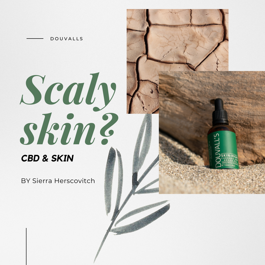 Scaly Skin: CBD Moisturiser to the Rescue by Sierra Herscovitch