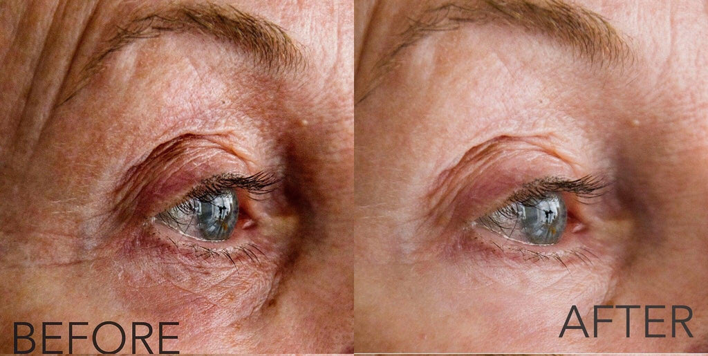 before after, before and after, eye serum, brighter eyes, anti-aging, smoother skin, crowsfeet, fine lines. 
