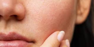 Working Out Your Skin Type